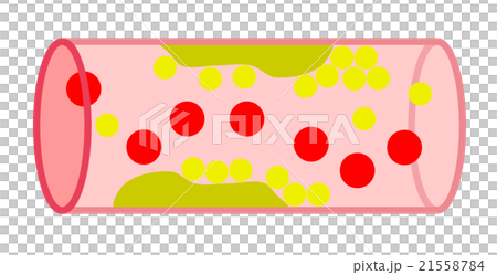 血管 血管 21558784