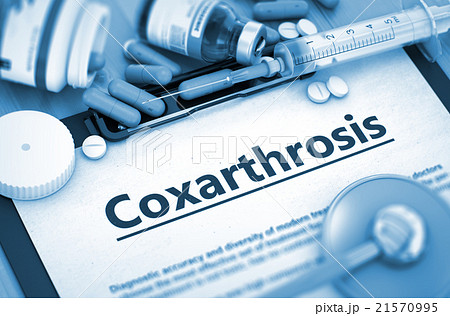 Coxarthrosis Diagnosis. Medical Concept.  21570995