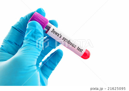 Down syndrome test 21625095