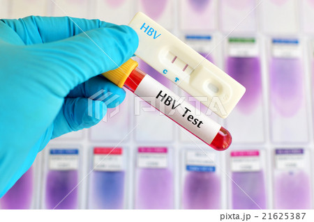 Hepatitis B virus test 21625387