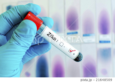 Zika virus test Zika virus test 21648509
