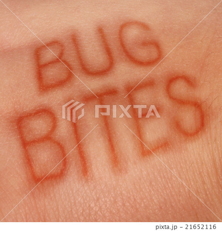 Bug Bites 21652116
