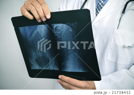 doctor observing a skeleton radiograph 21738432