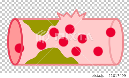 Blood vessel - Stock Illustration [21817499] - PIXTA