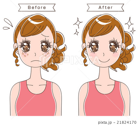 シミに悩む女性のイラスト 21824170