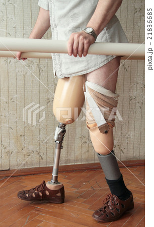 Prosthesis Prosthesis 21836685