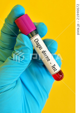 Chagas disease (American trypanosomiasis) test 21946672