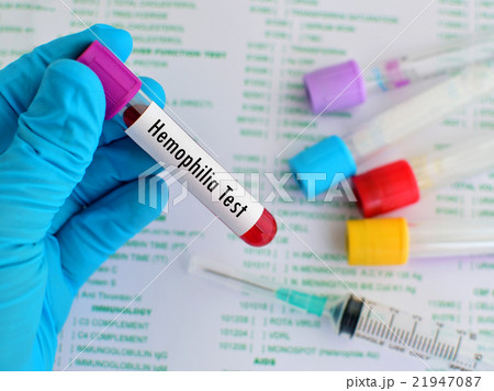 Hemophilia test Hemophilia test 21947087