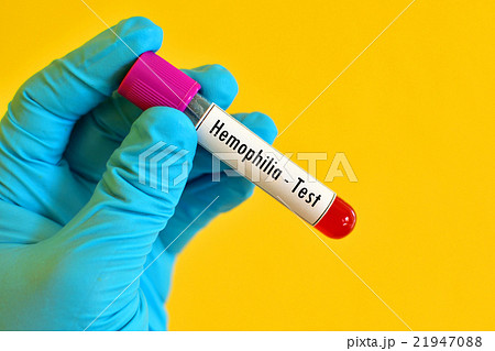 Hemophilia test Hemophilia test 21947088