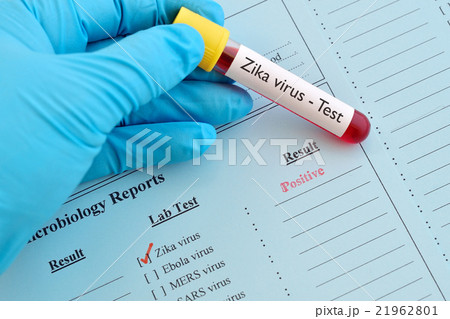 Zika virus positive 21962801