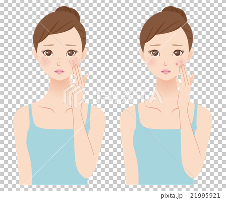 Women suffering from skin problems beauty skin care 21995921