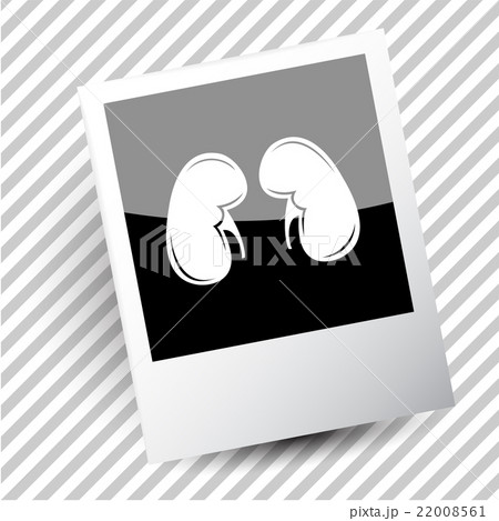 kidneys. 22008561