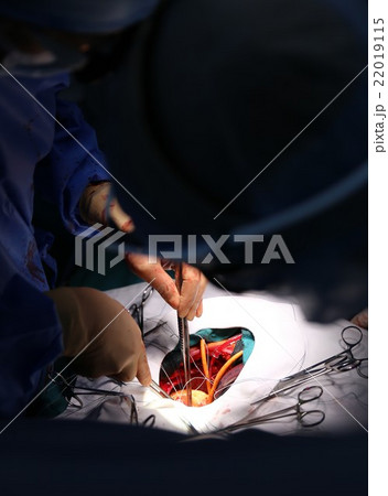 手術(術野) 手術(術野) 22019115