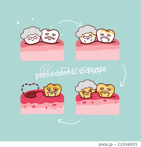 senior tooth with periodontal disease senior tooth with periodontal disease 22036935