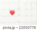 心電図 22050776