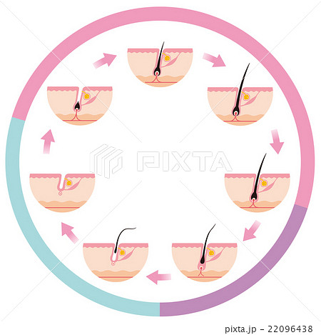 脱毛　毛周期　ヘアサイクル 22096438