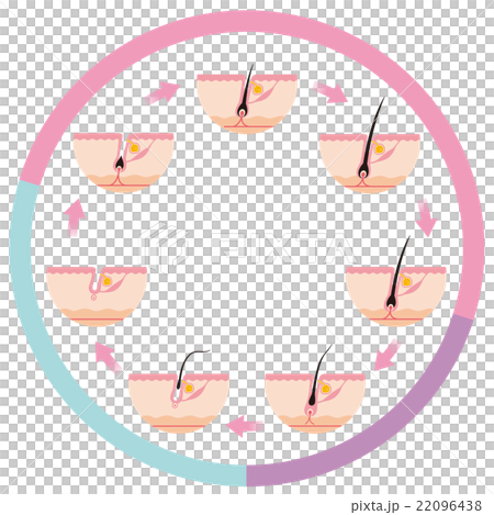 脱毛　毛周期　ヘアサイクル 22096438