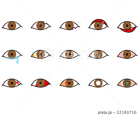 眼のトラブル 眼のトラブル 22163710