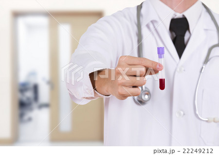 close up a medical test glass with blood close up a medical test glass with blood 22249212