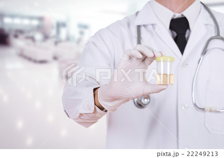doctor's hand holding a bottle of urine sample in doctor's hand holding a bottle of urine sample in 22249213