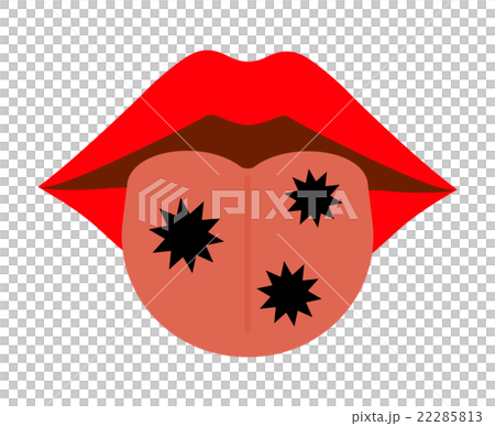 舌に付着した菌 舌に付着した菌 22285813