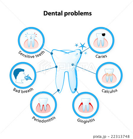 dental problem 22313748