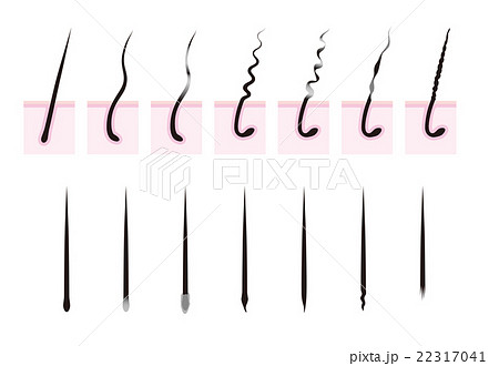 縮毛 抜け毛の毛根 のイラスト素材