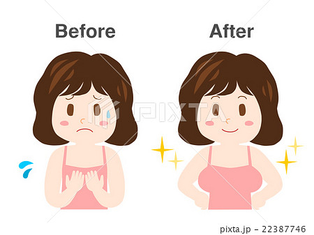 女性 バストアップ イラスト Before After のイラスト素材