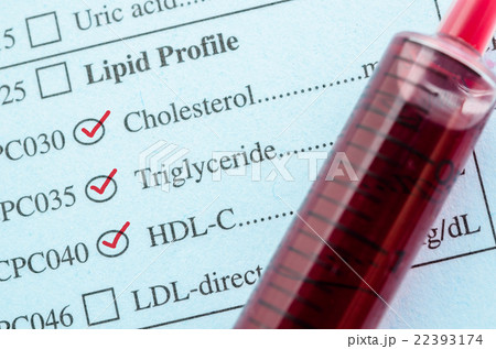 Red mark check on Cholesterol, and HDL-Con request 22393174