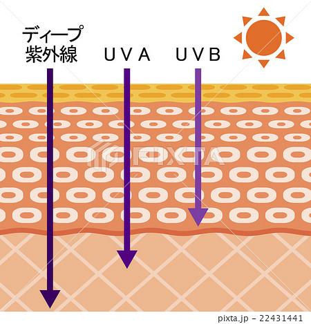 紫外線の図 紫外線の図 22431441