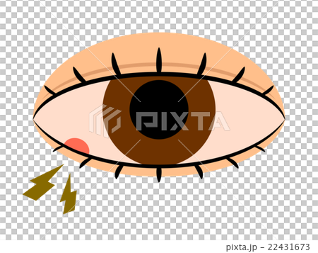 ものもらい 22431673