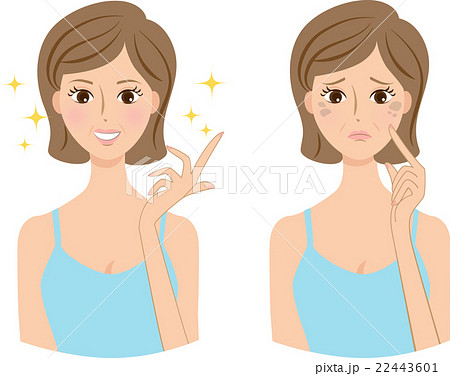 女性 ミドル 肌の悩み シミ before&after 女性 ミドル 肌の悩み シミ before&after 22443601
