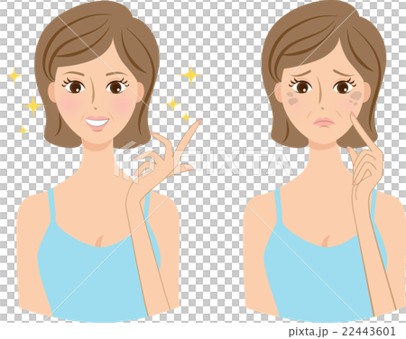 女性 ミドル 肌の悩み シミ before&after 女性 ミドル 肌の悩み シミ before&after 22443601