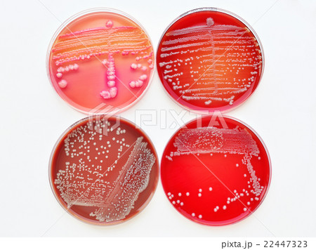 Bacteria culture plate Bacteria culture plate 22447323