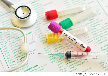 Blood for lead test 22447904