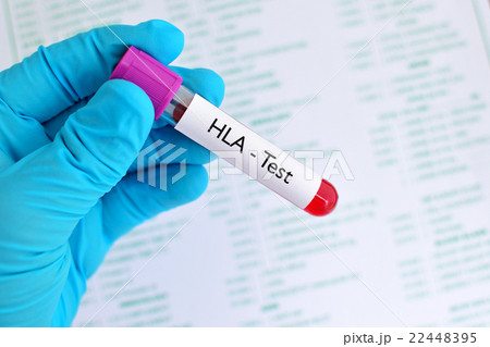 Blood for HLA test 22448395