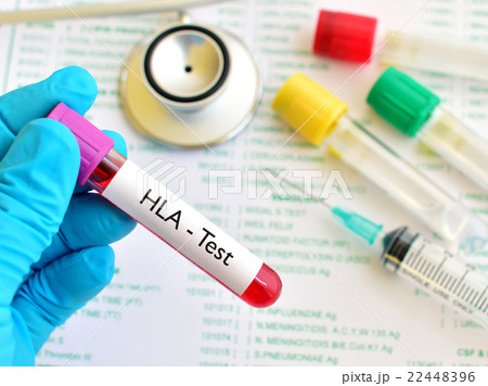 Blood for HLA test 22448396