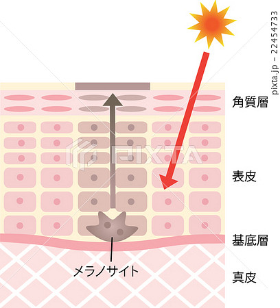 しみ肌の構造 22454733