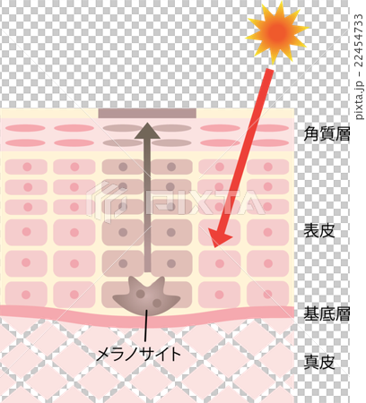 しみ肌の構造 22454733