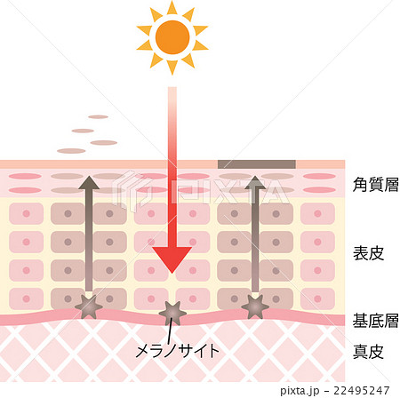 しみ 肌のイラスト素材