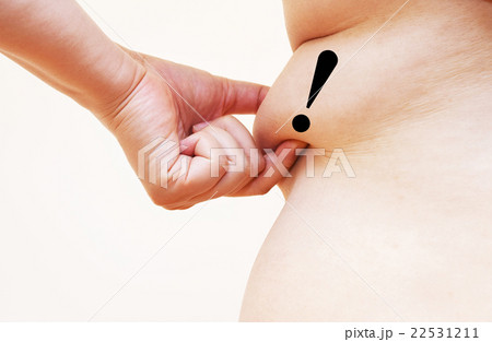 贅肉のイメージ 贅肉のイメージ 22531211