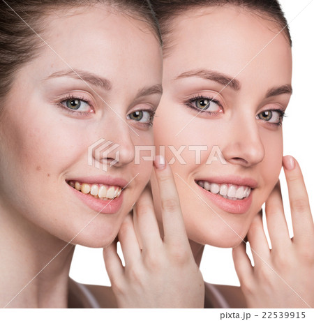 Young woman without and with makeup Young woman without and with makeup 22539915