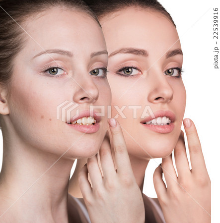 Young woman without and with makeup 22539916