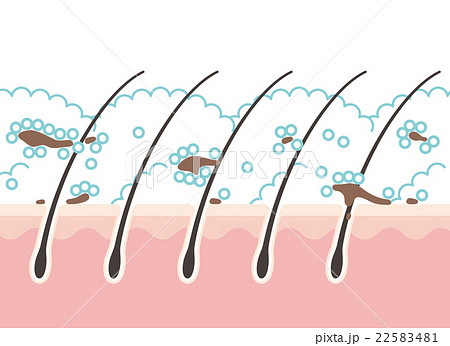 洗浄中の頭皮のイラスト素材