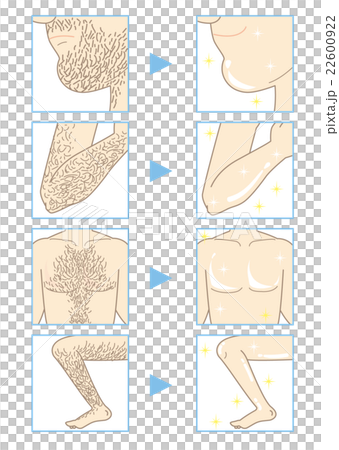 メンズエステ・脱毛（部分Aタイプ） 22600922