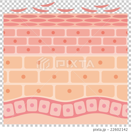 Sectional view of skin 22602142