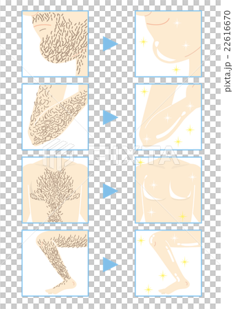 Men's Aesthetic · Hair Removal (Part B Type) 22616670