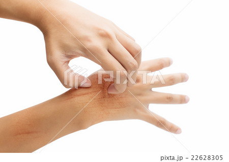 Women scratch the itch with hand Women scratch the itch with hand 22628305