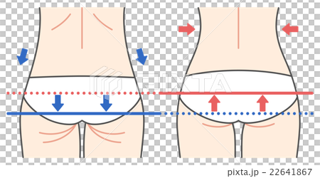 ヒップのビフォーアフター（矢印付き） 22641867
