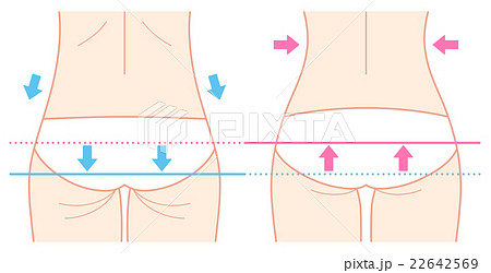 ヒップのビフォーアフター（矢印付き、繊細） 22642569